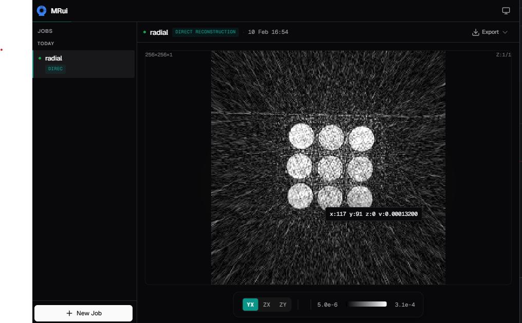 MRui reconstruction interface showing a reconstructed image and processing controls